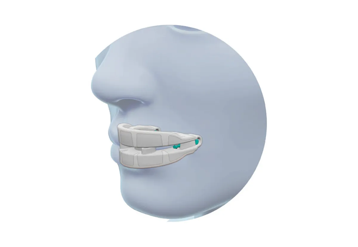 EyeQue Corporation Anti Snoring Mouthpiece Device