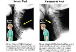 POSTURE PRO, INC. At Home Neck and Back Pain Reliever