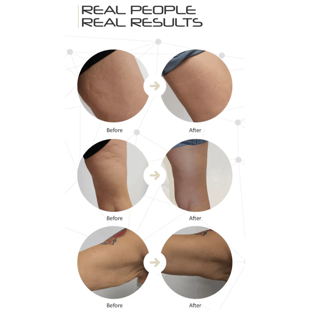 Heat in A Click LLC LED Cellulite Reducing Device