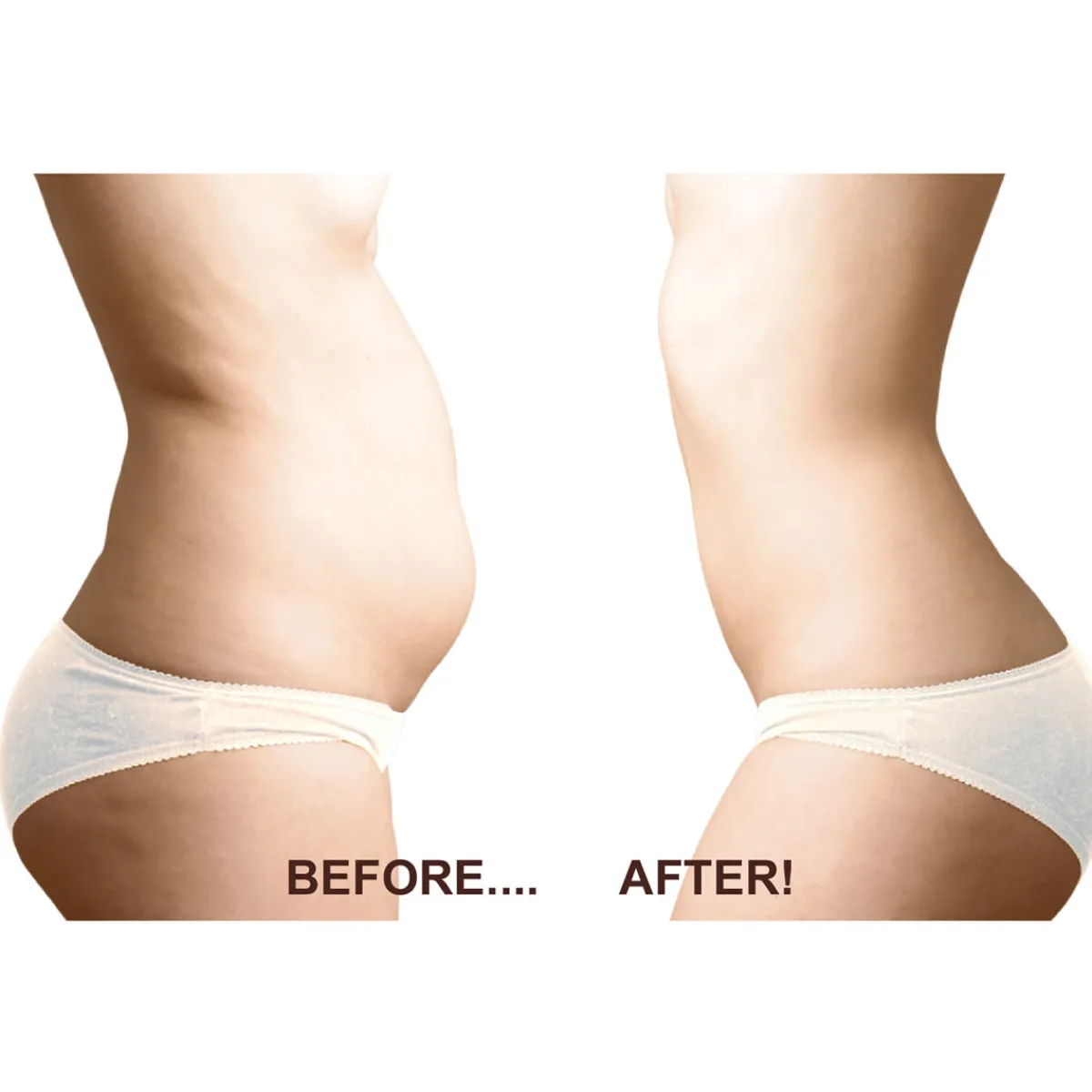 Beauty Ko LLC Ultimate Fat Freezer