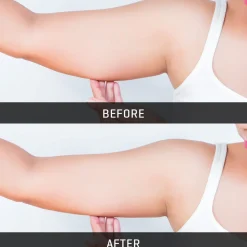 Teleshop Inc. (Beauty Ko LLC) Underarm Toner