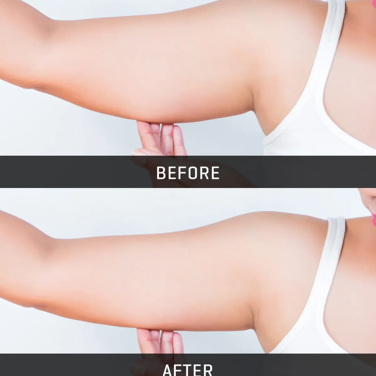 Teleshop Inc. (Beauty Ko LLC) Underarm Toner