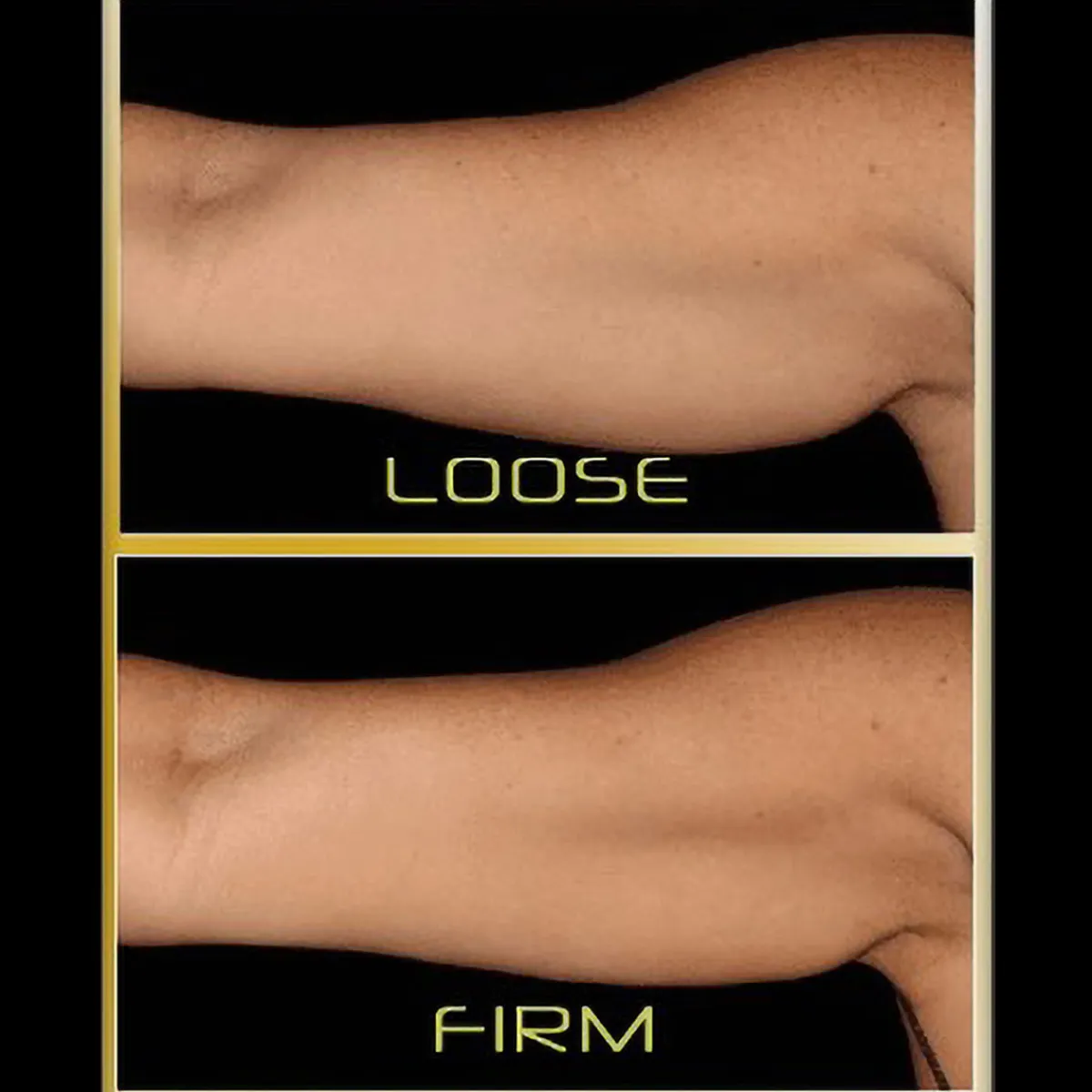 Teleshop Inc. (Beauty Ko LLC) Underarm Toner