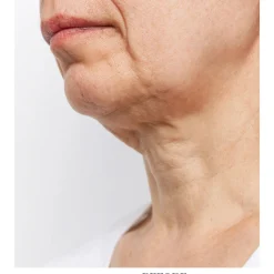 sharper image Wrinkle Reducing Neck Therapy Device